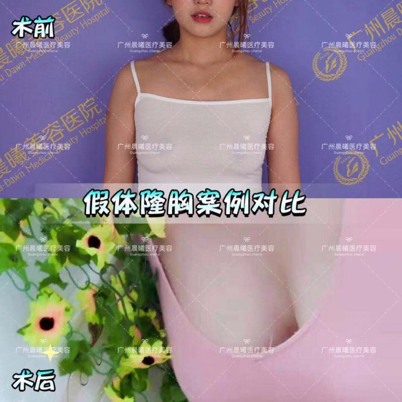 案例图片