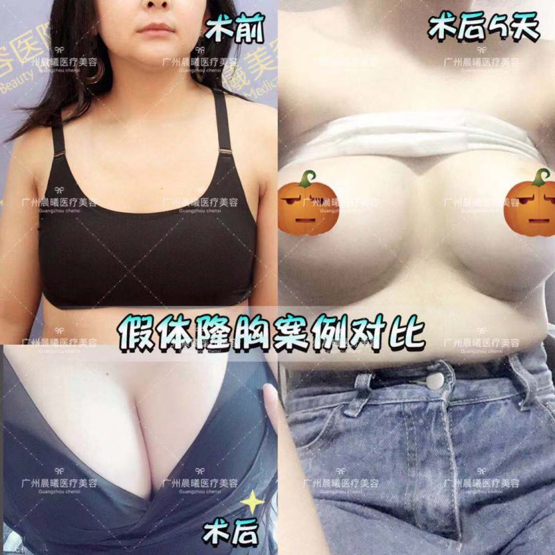 案例图片