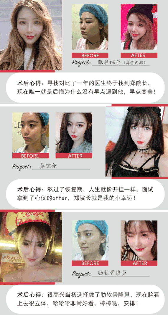 案例图片