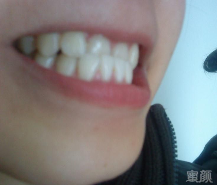 https://img.yiyiaimei.com/mnt/Editor/2020-01-31/5e33cc1fd5b94.jpg