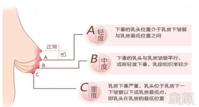 案例图片