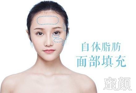 https://img.yiyiaimei.com/mnt/Editor/2020-02-15/5e47c54a48f89.jpg