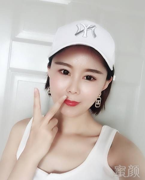 https://img.yiyiaimei.com/mnt/Editor/2020-02-16/5e48f9fe93a8a.jpg