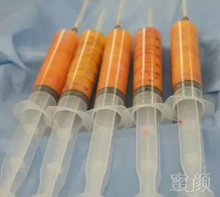 https://img.yiyiaimei.com/mnt/Editor/2020-02-19/5e4d01d69afc8.jpg