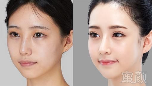 https://img.yiyiaimei.com/mnt/Editor/2020-02-27/5e5781e8cd92a.jpg