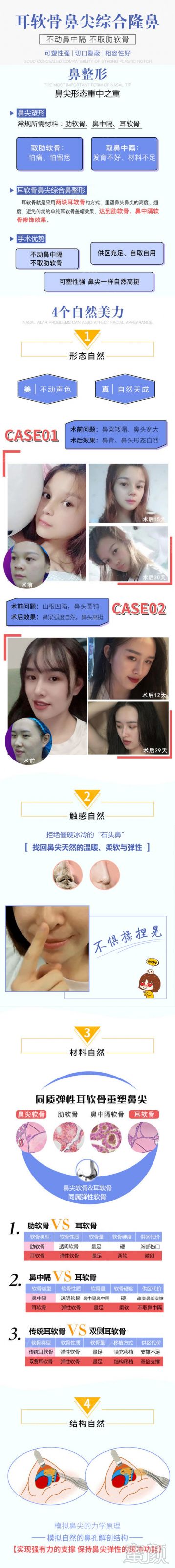 https://img.yiyiaimei.com/mnt/Editor/2020-03-12/5e6a0cdb95770.jpg