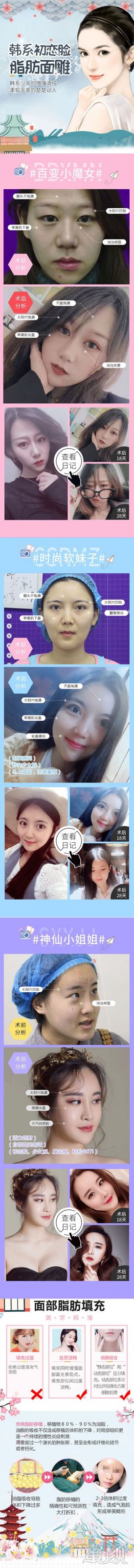 https://img.yiyiaimei.com/mnt/Editor/2020-03-12/5e6a11eab4caa.jpg