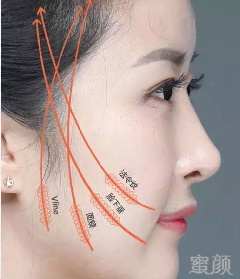 案例图片