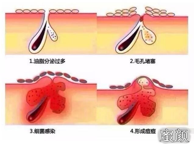 案例图片