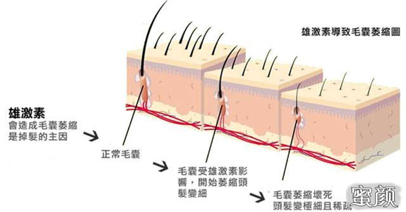 案例图片