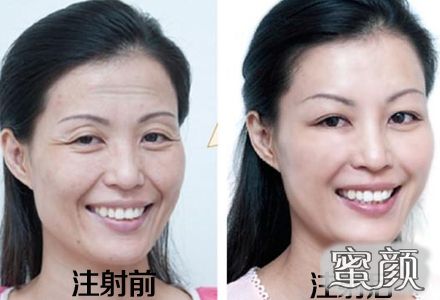 案例图片