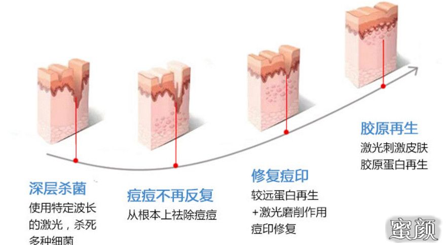 案例图片