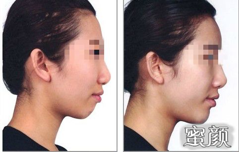 https://img.yiyiaimei.com/mnt/Editor/2020-05-06/5eb27a77dd866.jpg
