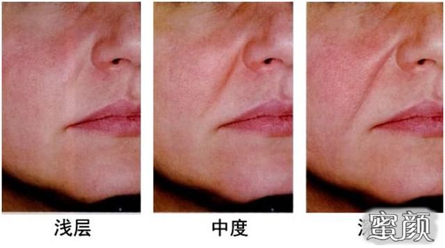 https://img.yiyiaimei.com/mnt/Editor/2020-05-08/5eb4cd8c2a13d.jpg