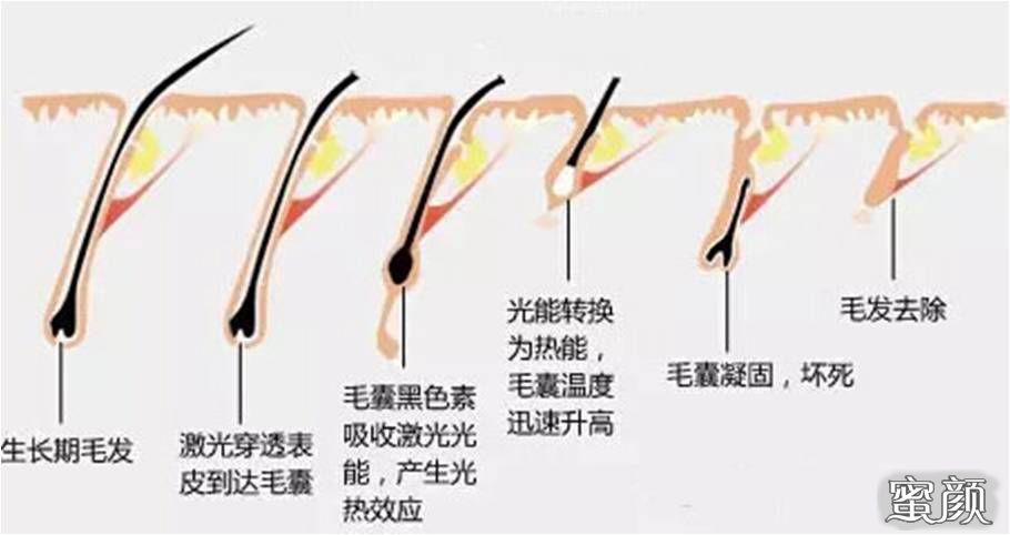 案例图片