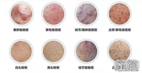 https://img.yiyiaimei.com/mnt/Editor/2020-05-12/5eba24122daaa.jpg