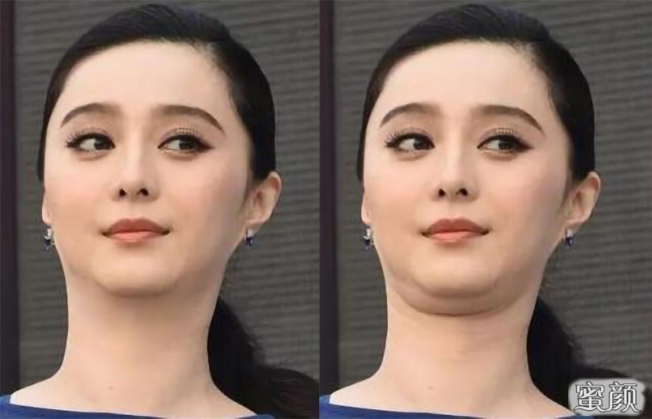 案例图片