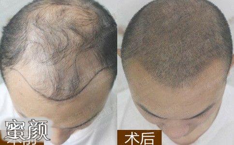 https://img.yiyiaimei.com/mnt/Editor/2020-05-13/5ebb92eb15f05.jpg 案例图片