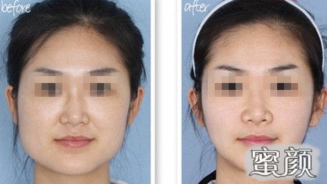 https://img.yiyiaimei.com/mnt/Editor/2020-05-15/5ebe535a4b2bd.jpg