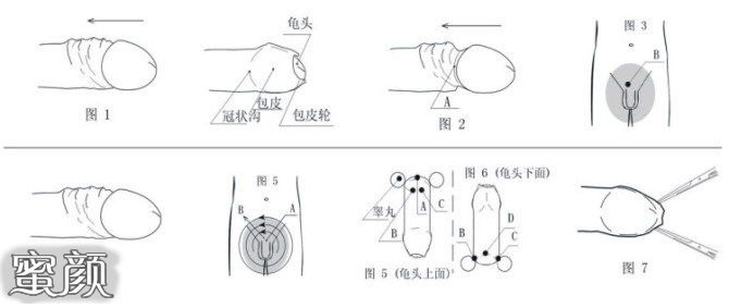 案例图片