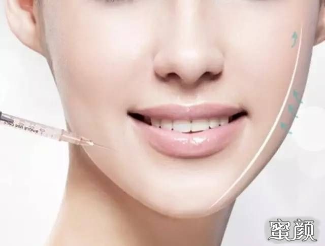 https://img.yiyiaimei.com/mnt/Editor/2020-05-17/5ec0afa2da69a.jpg