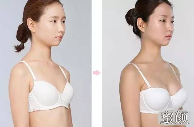 https://img.yiyiaimei.com/mnt/Editor/2020-05-18/5ec292fc15ec6.jpg