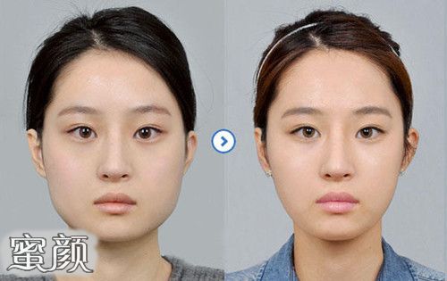 https://img.yiyiaimei.com/mnt/Editor/2020-05-19/5ec3ad3565396.jpg 案例图片