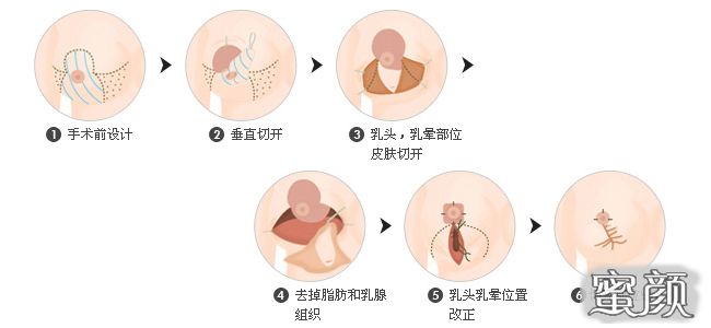 案例图片