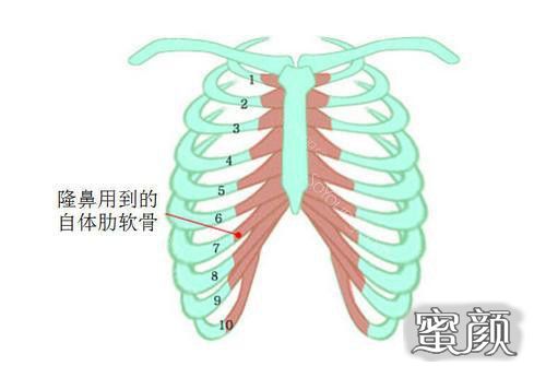 案例图片