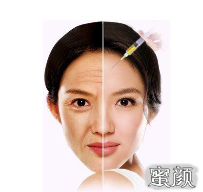 https://img.yiyiaimei.com/mnt/Editor/2020-05-27/5ece214874682.jpg