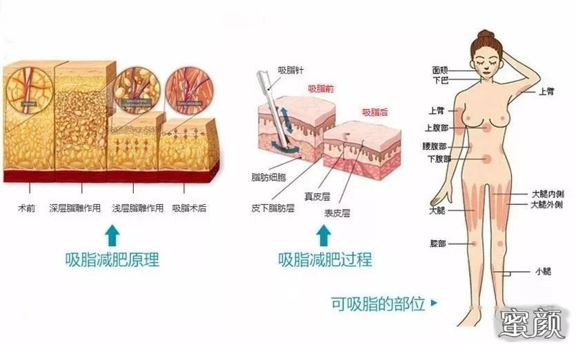 案例图片