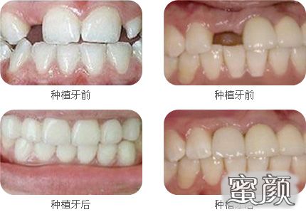 案例图片