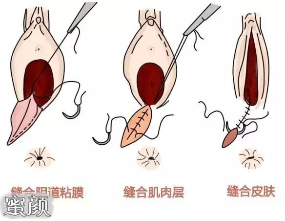 案例图片