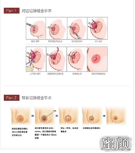 案例图片