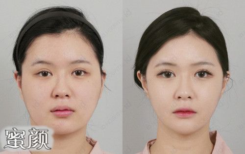 https://img.yiyiaimei.com/mnt/Editor/2020-06-01/5ed4a69315121.jpg