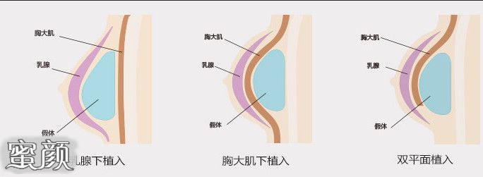 案例图片