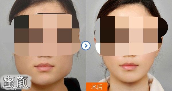 案例图片