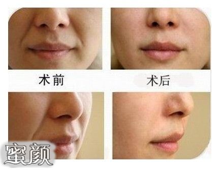 案例图片