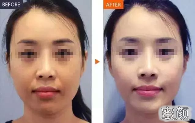 https://img.yiyiaimei.com/mnt/Editor/2020-06-14/5ee6124c65967.jpg