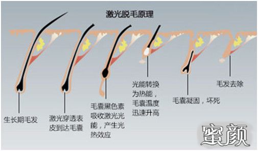 案例图片