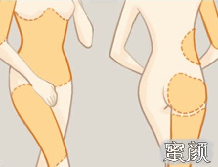 案例图片