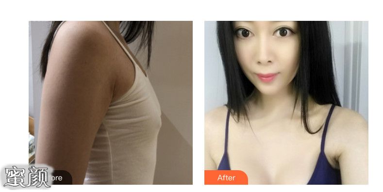 https://img.yiyiaimei.com/mnt/Editor/2020-06-22/5ef0bf1174a4f.jpg