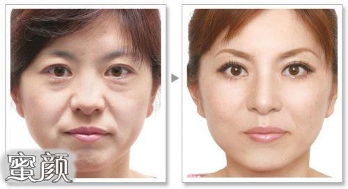 https://img.yiyiaimei.com/mnt/Editor/2020-06-23/5ef1c9f13a0e6.jpg