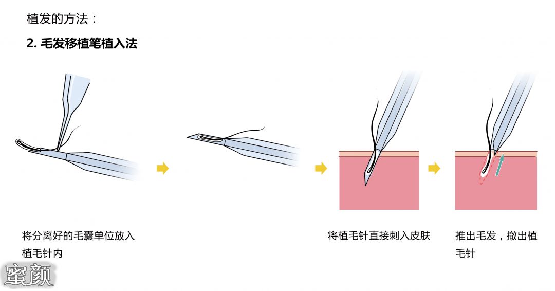 案例图片