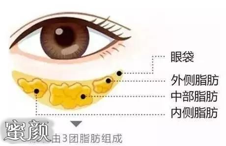 案例图片