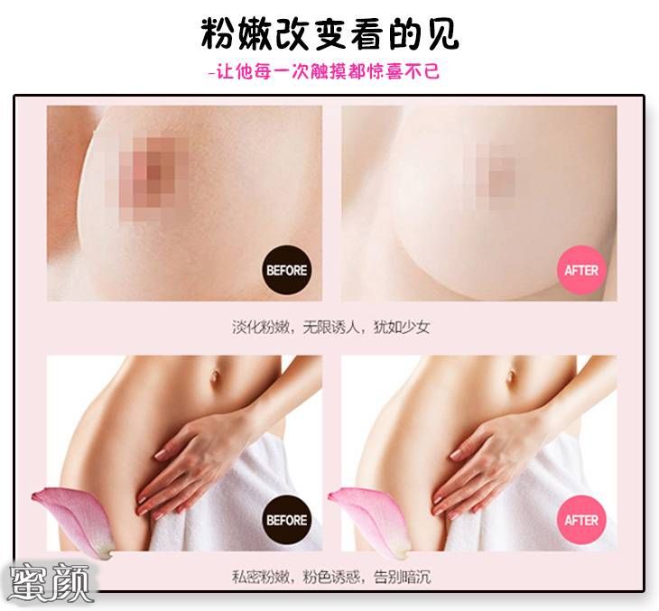 https://img.yiyiaimei.com/mnt/Editor/2020-06-27/5ef6e177d32a6.jpg