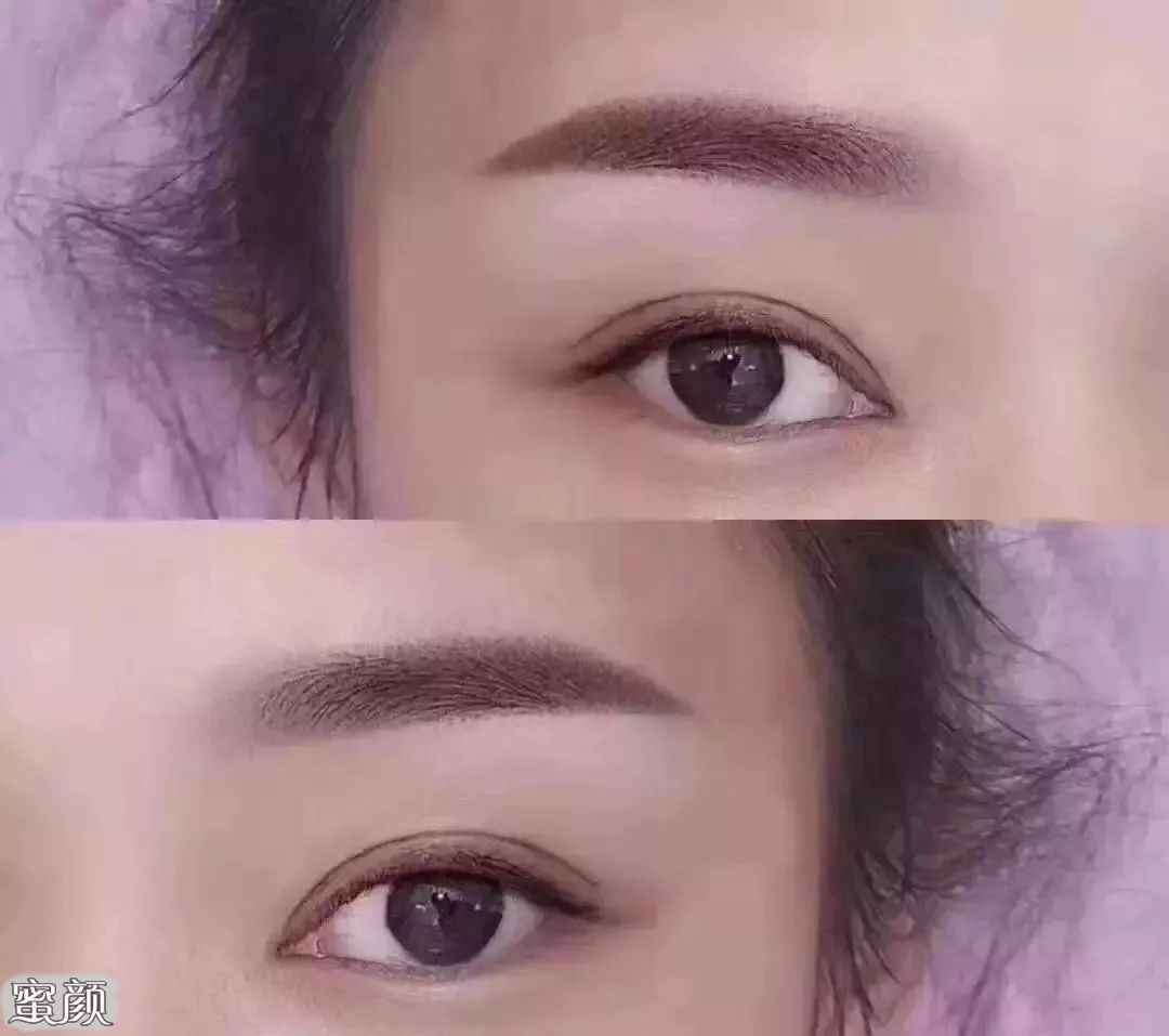 案例图片