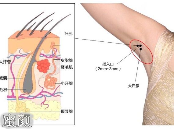 案例图片