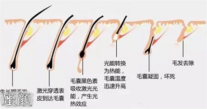 案例图片