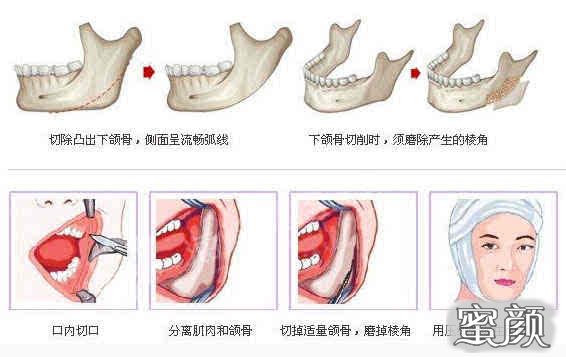 案例图片